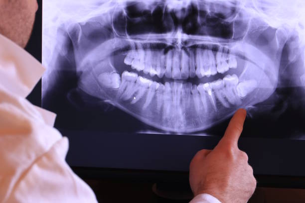 Best Emergency Denture Repair in Smyrna, DE